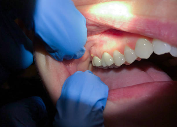 Best Urgent Care for Lost Fillings or Crowns in Silver Lakes, CA